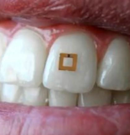 Znanstvenici osmislili senzor na zubu koji bilježi unos hrane